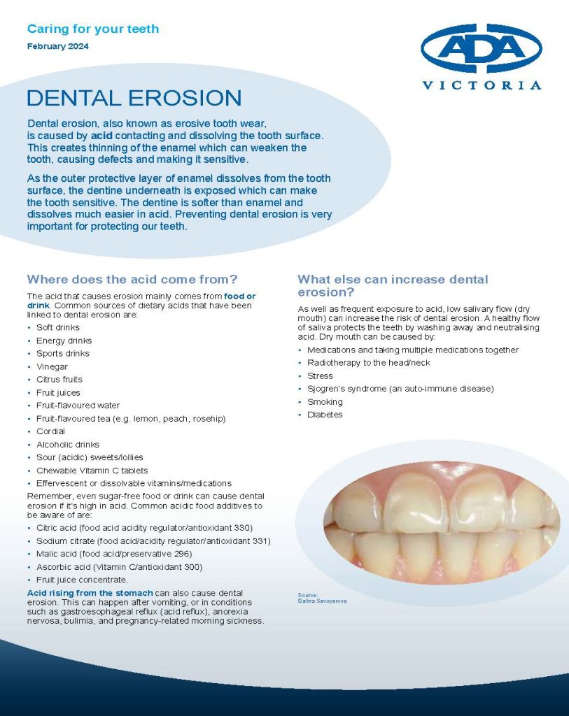 Fact Sheet Oral Health Dental Erosion UPDATED Page 1