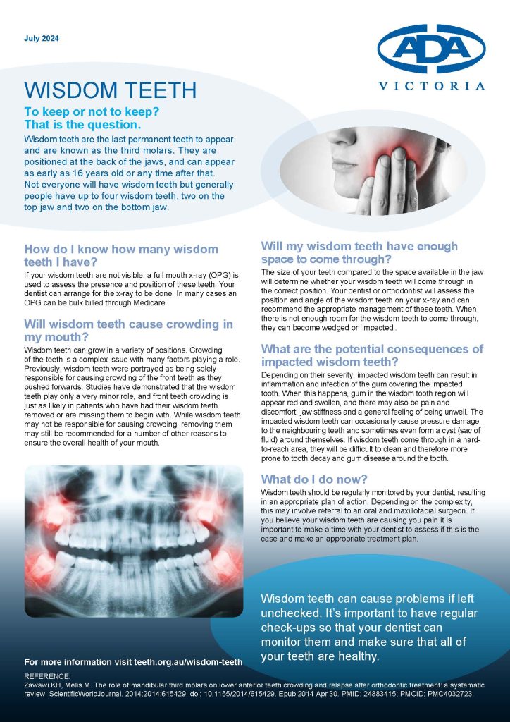 Fact Sheet Oral Health Wisdom Teeth July 2024
