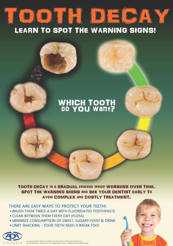 Poster Oral Health Decay